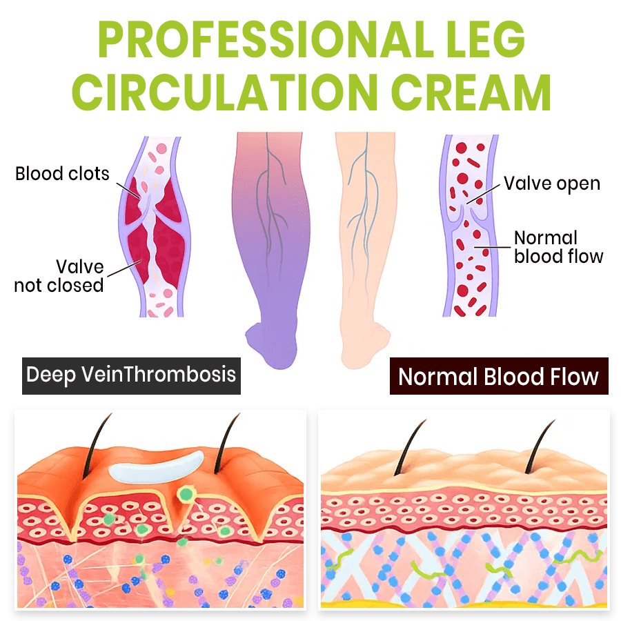 NEENCE® Professional Leg Circulation Cream_Ultra01