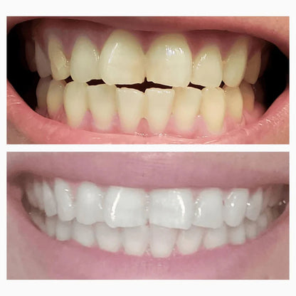 Magic Whitening Toothpaste NEENCE® Powder with Hydroxyapatite