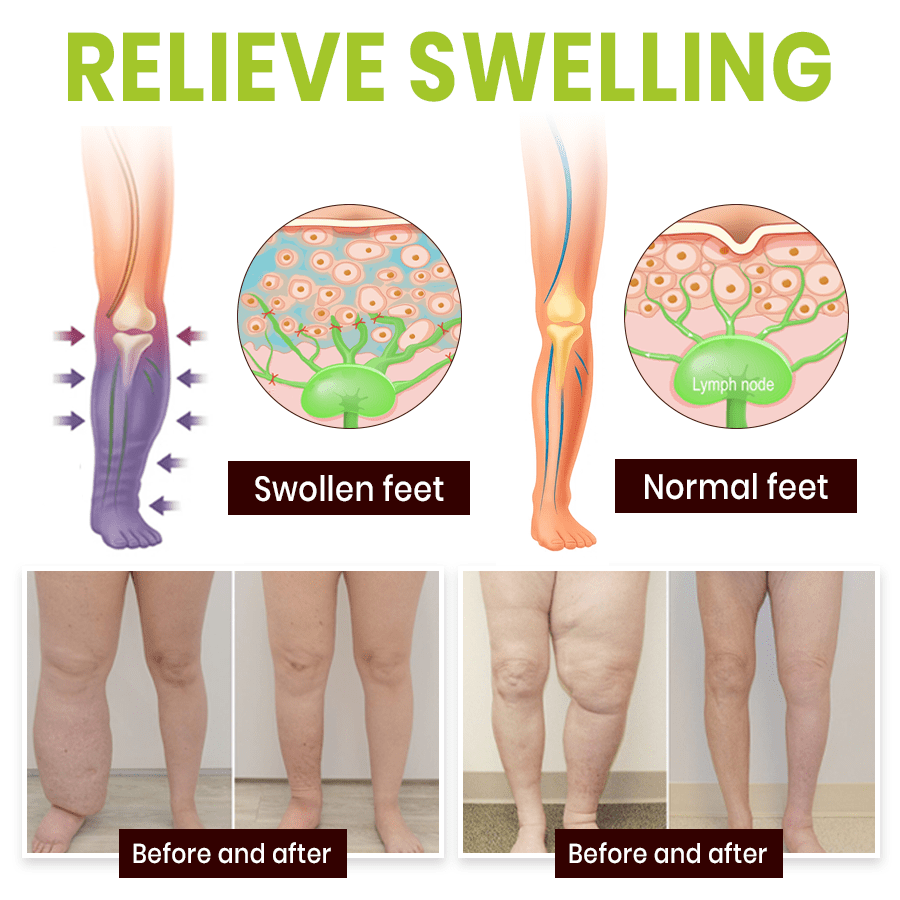 NEENCE® Professional Leg Circulation Cream_Ultra01