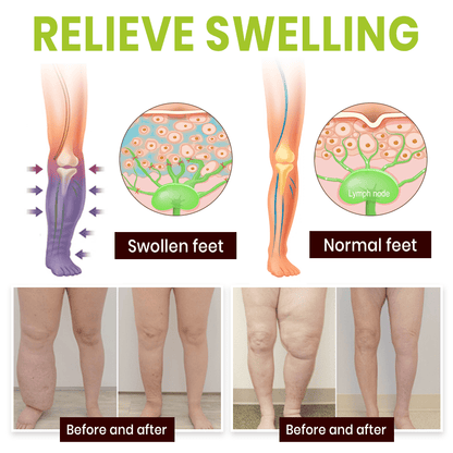 NEENCE® Professional Leg Circulation Cream_Ultra01