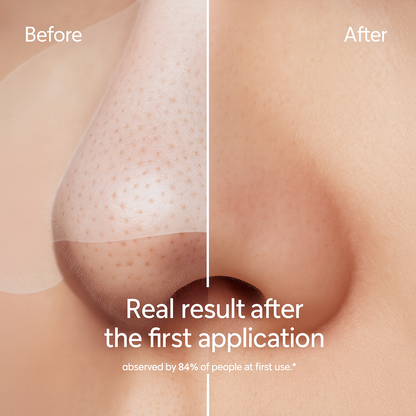 GSUNLEO Blackheads Nose Patches