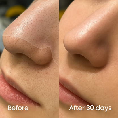 GSUNLEO Blackheads Nose Patches